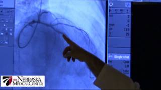 Explaining the Procedure Peripheral Angiogram [upl. by Eisiam441]