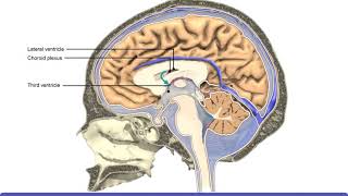 Subarachnoid Hemorrhage SAH Computed Tomography Scan Findings [upl. by Neelrihs784]