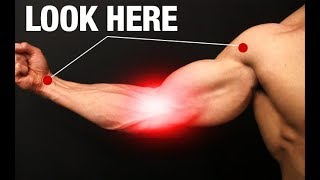 How to Fix Elbow Pain ONE SIMPLE EXERCISE [upl. by Steiner]