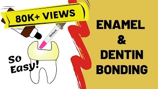 Enamel and Dentin Bonding Simplified [upl. by Ntsuj]