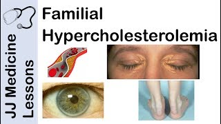 Cholesterol animation  Heart disease risk factors [upl. by Eillehs]