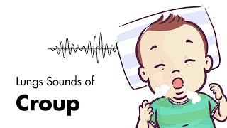 Sounds of Croup Laryngotracheitis  Lung Sounds  MEDZCOOL [upl. by Elleirb]