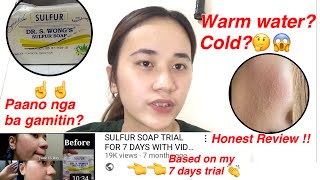 Dr S Wongs Sulfur Soap paano gamitin Honest Review [upl. by Stannwood]