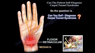 Carpal tunnel syndrome  Tinel’s sign and Phalen’s sign  Clinical Examination [upl. by Yl]