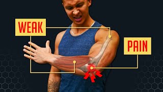 How To Fix Elbow Pain BULLETPROOF YOUR ELBOWS [upl. by Ivonne]