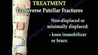 Patellar Fractures  Everything You Need To Know  Dr Nabil Ebraheim [upl. by Lehsreh807]