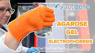 Agarose Gel Electrophoresis [upl. by Eentruoc931]