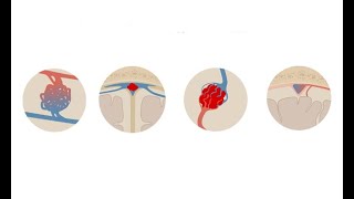 Meninges of the Brain  3D Anatomy Tutorial [upl. by Henghold458]