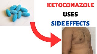 KETOCONAZOLE NIZORAL Uses Side effects Review Shampoo Cream Soap Lotion [upl. by Aidil]