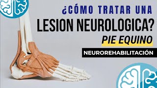 🧠 REHABILITACIÓN NEUROLÓGICA 🦶 Pie Equino  Lesión Cerebral [upl. by Bonnette285]