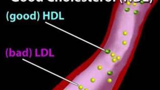 Understanding Cholesterol Cholesterol 1 [upl. by Molini]