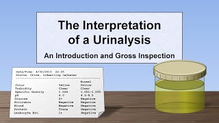 Interpretation of the Urinalysis Part 1  Introduction and Inspection [upl. by Haeluj124]