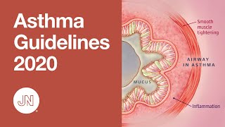 Asthma Guidelines Update 2020  Diagnosis and Management [upl. by Aitan]